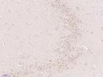 Gliomedin Antibody in Immunohistochemistry (Paraffin) (IHC (P))