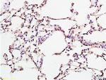CD274 Antibody in Immunohistochemistry (Paraffin) (IHC (P))