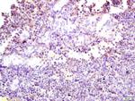 Phospho-DAB2 (Ser24) Antibody in Immunohistochemistry (Paraffin) (IHC (P))