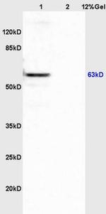 APBA3/Mint3/X11gamma Antibody in Western Blot (WB)