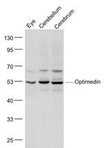 OLFM3/Optimedin Antibody in Western Blot (WB)