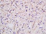 MDGA2 Antibody in Immunohistochemistry (Paraffin) (IHC (P))
