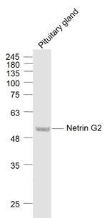 Netrin G2 Antibody in Western Blot (WB)