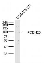PCDH20 Antibody in Western Blot (WB)