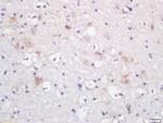 beta Adducin Antibody in Immunohistochemistry (Paraffin) (IHC (P))