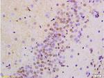 AMPK alpha-1 Antibody in Immunohistochemistry (Paraffin) (IHC (P))