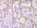 SPRR3/Cornin B Antibody in Immunohistochemistry (Paraffin) (IHC (P))