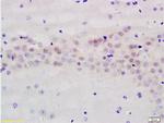 AMPK beta 1 + 2 Antibody in Immunohistochemistry (Paraffin) (IHC (P))