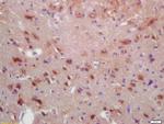 MYRF/C11orf9 Antibody in Immunohistochemistry (Paraffin) (IHC (P))