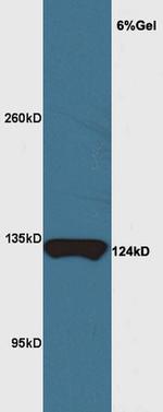 MYRF/C11orf9 Antibody in Western Blot (WB)