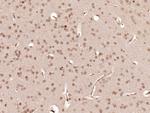 LHX2 Antibody in Immunohistochemistry (Paraffin) (IHC (P))