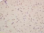 Musashi 1/2 Antibody in Immunohistochemistry (Paraffin) (IHC (P))