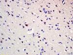Pumilio 1 Antibody in Immunohistochemistry (Paraffin) (IHC (P))