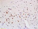 Sema3A Antibody in Immunohistochemistry (Paraffin) (IHC (P))