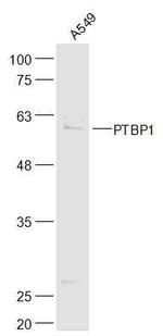 PTBP1 Antibody in Western Blot (WB)