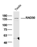 RAD50 Antibody in Western Blot (WB)