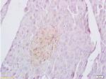 Sema4C Antibody in Immunohistochemistry (Paraffin) (IHC (P))
