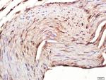 CACNA1F Antibody in Immunohistochemistry (Paraffin) (IHC (P))
