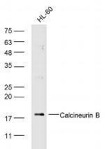 Calcineurin B/PP2B-B1 Antibody in Western Blot (WB)