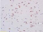 5-HTR1A Antibody in Immunohistochemistry (Paraffin) (IHC (P))