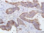 DERLIN-1 Antibody in Immunohistochemistry (Paraffin) (IHC (P))