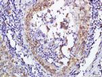 DERLIN-1 Antibody in Immunohistochemistry (Paraffin) (IHC (P))