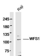 WFS1 Antibody in Western Blot (WB)