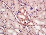 Phospho-CTBP1 (Ser422) Antibody in Immunohistochemistry (Paraffin) (IHC (P))