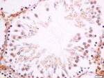 DMO/Dmrt1a Antibody in Immunohistochemistry (Paraffin) (IHC (P))
