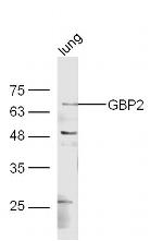 GBP2 Antibody in Western Blot (WB)