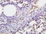 SGLT1 Antibody in Immunohistochemistry (Paraffin) (IHC (P))