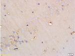 SGLT1 Antibody in Immunohistochemistry (Paraffin) (IHC (P))