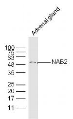 NAB2/MADER Antibody in Western Blot (WB)