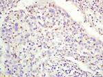 RFC1 Antibody in Immunohistochemistry (Paraffin) (IHC (P))