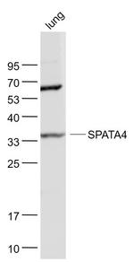 TSARG2 Antibody in Western Blot (WB)