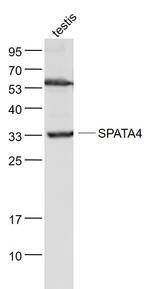 TSARG2 Antibody in Western Blot (WB)