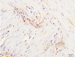 Gemin 2 Antibody in Immunohistochemistry (Paraffin) (IHC (P))