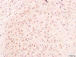 Neuroglycan C Antibody in Immunohistochemistry (Paraffin) (IHC (P))