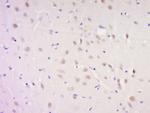 SNAP91/AP180 Antibody in Immunohistochemistry (Paraffin) (IHC (P))