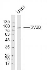 SV2B Antibody in Western Blot (WB)
