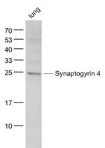 Synaptogyrin 4 Antibody in Western Blot (WB)