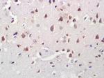 A2LD1/GGACT Antibody in Immunohistochemistry (Paraffin) (IHC (P))