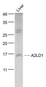 A2LD1/GGACT Antibody in Western Blot (WB)