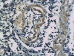 SSTR2/Somatostatin Receptor 2 Antibody in Immunohistochemistry (Paraffin) (IHC (P))