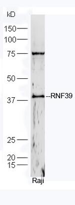 RNF39 Antibody in Western Blot (WB)