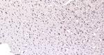 AKR1C3/DD3 Antibody in Immunohistochemistry (Paraffin) (IHC (P))