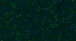 Progestin Receptor Beta/MPRB Antibody in Immunohistochemistry (Paraffin) (IHC (P))
