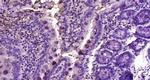 Progestin Receptor Beta/MPRB Antibody in Immunohistochemistry (Paraffin) (IHC (P))