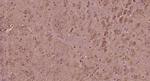 Progestin Receptor Beta/MPRB Antibody in Immunohistochemistry (Paraffin) (IHC (P))