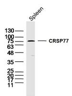 CRSP77 Antibody in Western Blot (WB)